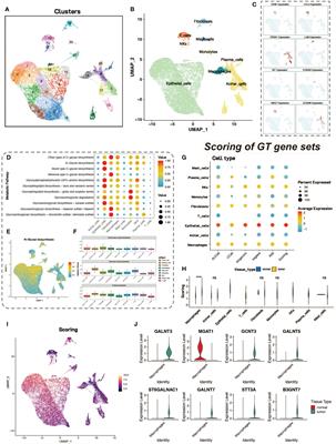 Role of glycosylation-related gene MGAT1 in pancreatic ductal adenocarcinoma